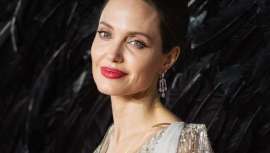 La intervención quirúrgica acorta la distancia entre la nariz y los labios creando una apariencia mucho más juvenil 