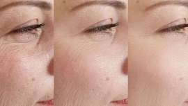 La Dra. Gema Pérez Sevilla nos desvela qué nos preocupa conforme pasan los años. Y por lo tanto, qué tratamientos son los más demandados y efectivos en cada caso