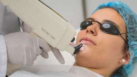 Instituto Médico Viator ha incorporado esta plataforma, cuyas tres tecnologías incluidas son capaces de conseguir resultados visibles en tratamientos para manchas y lesiones pigmentadas, cuperosis o varices, entre otras indicaciones