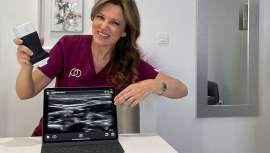 Herramienta de diagnóstico por imagen basada en los ultrasonidos que permite su evaluación, lo que supone un gran número de ventajas