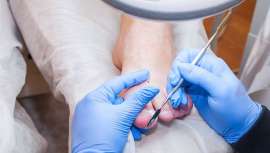 La nutrición, la onicosopía, la psoriasis ungueal, la onicomicosis, el melanoma de la uña y la traquioniquia serán temas de exposición en el próximo congreso de la EADV