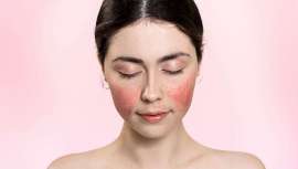 La doctora Eguren presenta El acné y la rosácea como nunca antes te lo habían explicado, una completa radiografía de ambas patologías dermatológicas, un manual práctico que desmonta algunos de los mitos más comunes en torno a estas enfermedades