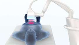 EON, un láser robótico, sin contacto, de 1064nm que se utiliza para el contorno corporal, con dos características importantes que demuestran que el dispositivo es la tecnología más avanzada en estética.