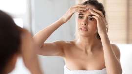 Germaine Goya nos explica cuáles son los trucos y tratamientos para combatir el indeseable acné veraniego