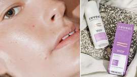 Renueva la piel sin resecarla y se usa durante la noche, con la recomendación de aplicar una alta protección solar durante el día 