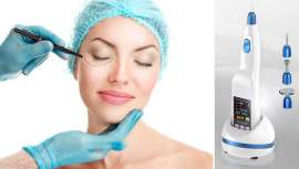 Se trata de un prodecimiento 100% indoloro y ambulatorio que sin dejar ningún tipo de cicatriz, consigue tensar la piel, revitalizando el rostro y dándole un aspecto más joven