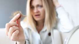 Después del verano empezamos a notar que perdemos más pelo de lo normal. Es un proceso habitual que no debe preocuparnos, aunque también es importante saber cuándo debemos acudir a un especialista