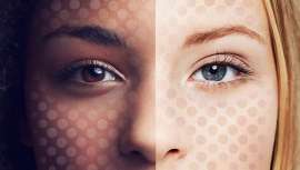 Además de disfrutar de 65 aplicaciones más, plataforma recomendada también para tratar lesiones vasculares, remodelar la piel, unificar el tono y mejorar su textura, así como para protocolos de depilación y marcas de acné