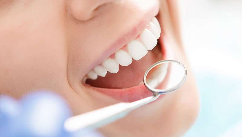 tratamiento dientes dentista sonrisa