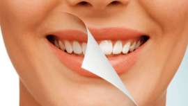 Mahi Masegosa, ex superviviente de SV 2019, desvela su próximo cambio estético: “quiero los dientes de Rihanna”