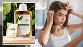 El nuevo ritual de esta gama de Klorane se adapta a las necesidades actuales de los consumidores que buscan, cada vez más, soluciones expertas de origen natural, eco responsabilidad, productos fáciles de utilizar y eficaces contra la caspa