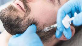 El tratamiento para conseguir esta mandíbula consiste en la infiltración de ácido hialurónico reticulado Extreme de MaiLi