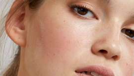 La Clínica de cirugía plástica y medicina estética Martín del Yerro/Amselem ofrece los mejores tratamientos para posibles malformaciones en las orejas causadas por el uso de pendientes pesados o el paso del tiempo