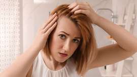 La alopecia en la mujer lleva a la depresión y además va en aumento. Estar informado como profesional, te permitirá no solo diagnosticar sino también aconsejar el mejor tratamiento  