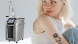 El láser PicoSure Pro simplifica la eliminación de tatuajes y lesiones pigmentadas benignas, pero también es muy efectivo en el tratamiento de cicatrices del acné, arrugas y la revitalización de la piel