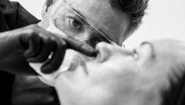 El Dr. Segarra, reconocido por sus revolucionarios tratamientos en labios, ha perfeccionado técnicas aprendidas en Canadá, haciéndolas propias como el tenging, el fanning, el bolus o el super fanning