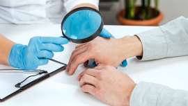 El diagnóstico, tratamiento y recomendaciones de cuidado de una genodermatosis está en manos de un genetista y un dermatólogo. Sin embargo, estos especialistas pueden referir a un inmunólogo si la afección es más compleja