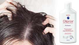 El comienzo del invierno suele coincidir con un incremento de la sensación de frío y un descenso de la humedad, dos condiciones climatológicas propias de la estación que agravan y/o provoca la dermatitis seborreica 