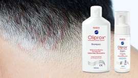 Olyan farma presenta un tratamiento combinado a través de su línea Oliprox de acción antifúngica y antibacteriana de amplio espectro para acabar con esta infección fúngica a la que temen todos los salones de belleza