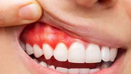 El 4 de febrero es el Día Mundial contra el Cáncer y la Dra. Eugenia Cervantes, desde Clínica Eugenia Cervantes de Estética Dental (C/Santiago Bernabéu 9, Madrid), nos advierte de la importancia de cuidar nuestra boca para prevenirlo