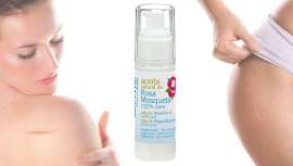 Sus grandes propiedades regeneradoras y reparadoras, entre otras muchas bondades, han colocado al aceite de rosa mosqueta en el olimpo de los activos favoritos de la dermocosmética