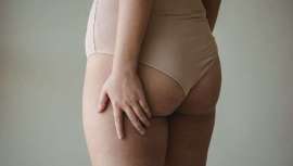 Son la zona del cuerpo donde se concentra un mayor cúmulo de grasa. Abarca los laterales externos de las caderas, la parte superior de los muslos y la parte baja del glúteo