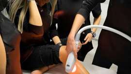 Referente nacional en el alquiler de equipos de depilación para el sector de la estética