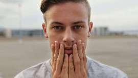 Este tipo de calvicie, que afecta hasta a un 20% de los varones, se conoce como alopecia androgenética y comienza a manifestarse en las áreas frontales de la cabeza, las entradas y la coronilla, según explica Hospital Capilar 