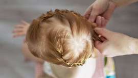 Este tipo de alopecia origina-se pelo cansaço prolongado sobre o couro cabeludo de penteados apanhados, tranças ou extensões, assim como pela utilização de acessórios como elásticos, cintas ou diademas que apertam 