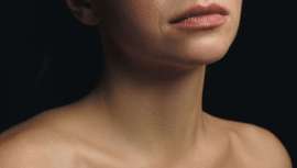 Descubre los consejos definitivos para prevenir (y mejorar) las arrugas en esta delicada zona, con la ayuda de la farmacéutica Belén Acero, titular de la Farmacia Avenida de América y especialista en dermofarmacia y nutrición