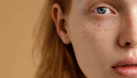 Aunque lo parezca, ambas no son lo mismo, nos explican las diferencias los especialistas de la estética y la medicina estética