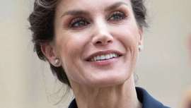 La Dra. Eugenia Cervantes de la Cínica Eugenia Cervantes especializada en Estética Dental, descubre, por las últimas fotografías de la consorte, que debería llevar nuevamente ortodoncia