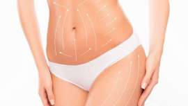 ¿Es la mejor técnica para acabar con grasa localizada? ¿Qué novedades hay? ¿Cuál es la mejor? Contesta la Dra. Conchita Pinilla, experta en cirugía plástica