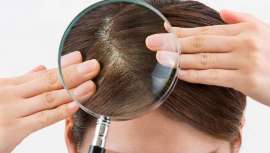 La piel que forma nuestro cuero cabelludo tiene una estructura particular y poco conocida. A menudo su cuidado no ha sido siempre el acertado