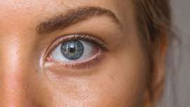 Nuria Aluart, beauty hunter de mumona.com, nos explica qué es, por qué empeora con la luz solar y los cosméticos que debes usar si la padeces