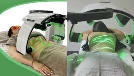 Emerald es el último equipo de reducción fabricado por Erchonia. Empresa especializada en láseres fríos de EE UU