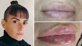 La naturalidad y el realismo son los pilares de su marca y por eso, Berta personaliza cada tratamiento y lo adapta a cada persona