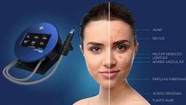 El láser azul Blauman es mucho más que una limpieza facial. Es una nueva manera de hacer estética. El único láser que elimina imperfecciones en la piel y que ha sido regulado como un equipo de uso estético según el Reglamento 2022/2347