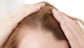 Buscar una solución rápida a la pérdida de cabello no es lo más efectivo. Es mejor consultar a los profesionales médicos y utilizar productos que realmente funcionen para revertir el problema