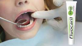 El tabaco, el azúcar o la mala higiene son algunos de los hábitos de vida que aumentan el riesgo de sufrir este problema