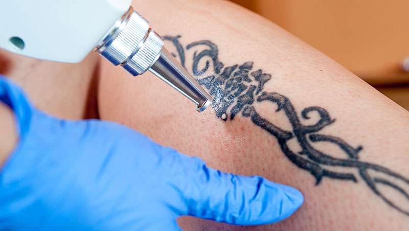 1 de cada 4 estadounidenses se arrepiente de su tatuaje