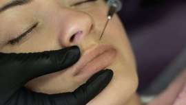 El gobierno del Reino Unido está pidiendo comentarios sobre su nuevo esquema de licencias propuesto para tratamientos estéticos en Inglaterra