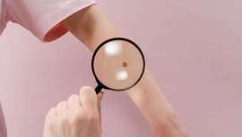 Se estima que en 2040 el melanoma se convertirá en el segundo tumor en incidencia global y el primero en incidencia en varones, por delante del cáncer de colon y el de pulmón