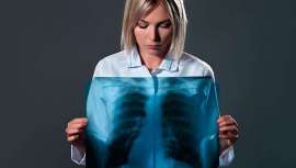 El cáncer de pulmón es uno de los más letales en España y ha crecido especialmente entre las mujeres