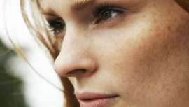 Las manchas de la piel o hiperpigmentaciones, son un problema cutáneo muy común, afectan a todo tipo de pieles, sobre todo en fototipos altos y en pieles altamente expuestas a radiación UV; y son más frecuentes en las mujeres que en hombres