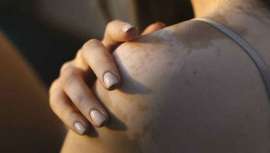 Existen problemas de la piel, como la psoriasis, la dermatitis atópica o el vitíligo, que mejoran en verano pero empeoran en invierno. La Dra. Pérez Sevilla, cirujana maxilofacial y experta en medicina estética facial, te explica los motivos