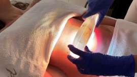 FHOS es el nuevo y avanzado tratamiento facial y corporal con resultados nunca antes alcanzados en solo 15 minutos