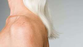 El tratamiento de rejuvenecimiento integral con Ellipse en el Centro de Estética Silvia Giralt es la mejor opción para deshacerse de las manchas solares tanto en rostro como en cuerpo