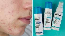 Biotic Pro es una gama facial creada para respetar la piel, enriquecida con ingredientes activos y un complejo prebiótico, que restaura el equilibrio de la microflora cutánea