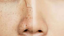 Clínica Menorca cuenta con una nueva doctora de medicina estética, la Dra. Tamara Vega Velázquez, con quien resolver dudas sobre medicina estética o ayudaros con vuestros temas